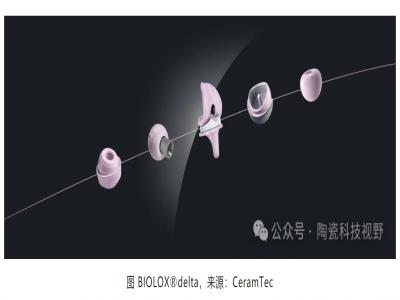 陶瓷材料在人工髖關節(jié)假體中的應用